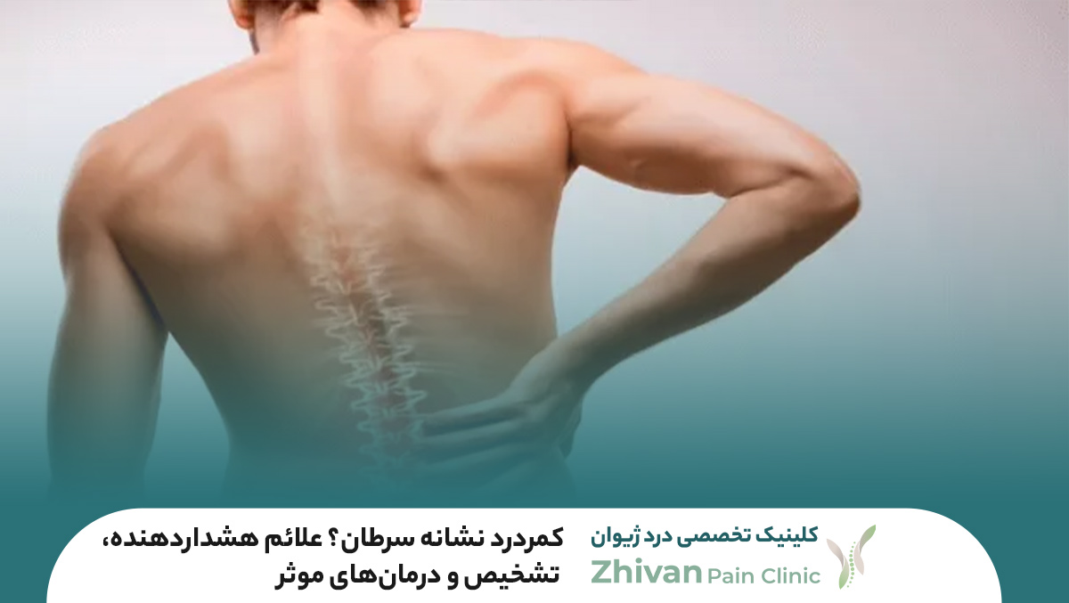 کمردرد نشانه سرطان؟ علائم هشداردهنده، تشخیص و درمان‌های موثر